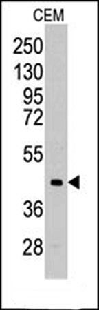 ALDOC antibody