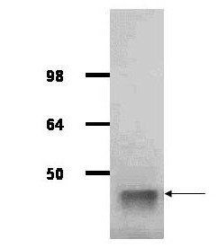 Aldolase antibody (Peroxidase)