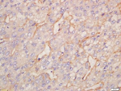 Aldolase C Rabbit Polyclonal Antibody