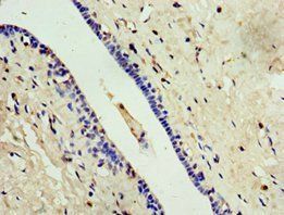 ALG1 antibody