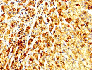 ALG11 Antibody