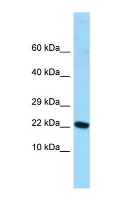 ALG13 antibody