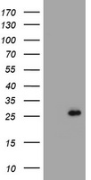 ALG2 antibody