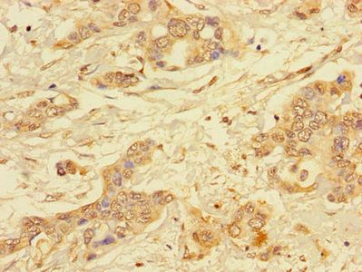 ALG2 Antibody
