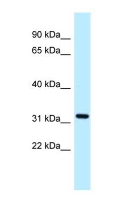 ALG5 antibody