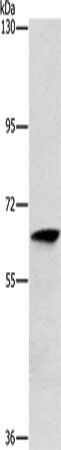 ALG6 antibody