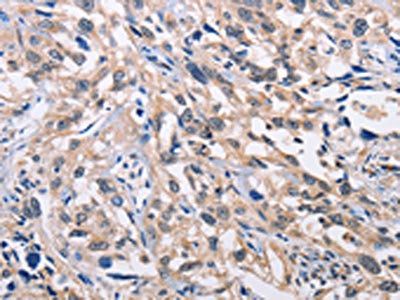 ALG8 Antibody