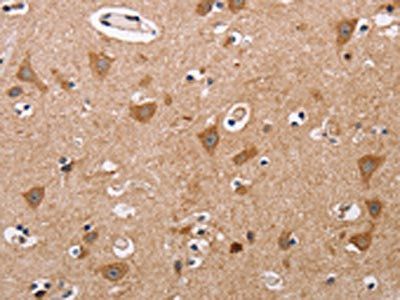 ALG9 Antibody