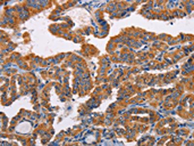 ALG9 Antibody