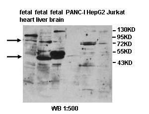 ALG9 Rabbit Polyclonal Antibody