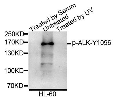 ALK (Phospho-Y1096) antibody