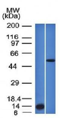 ALK (Anaplastic Lymphoma Kinase) / CD246 Antibody