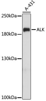 ALK antibody