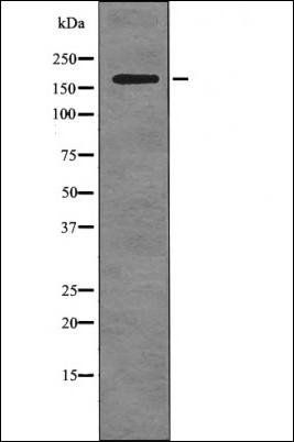 ALK (Phospho-Tyr1078) antibody