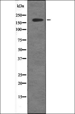 ALK (Phospho-Tyr1586) antibody