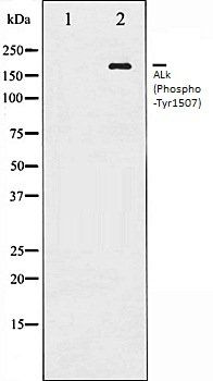 ALk (Phospho-Tyr1507) antibody