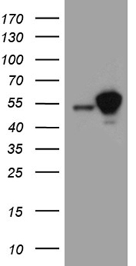Alkaline Phosphatase (ALPL) antibody
