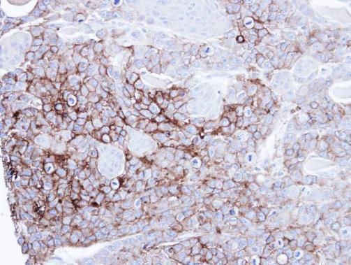Alkaline phosphatase Rabbit Polyclonal Antibody