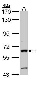 Alkaline phosphatase Rabbit Polyclonal Antibody