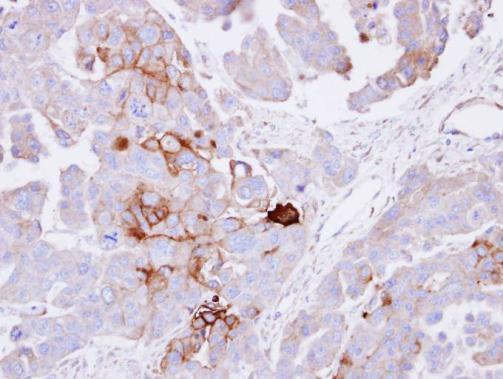 Alkaline Phosphatase Rabbit Polyclonal Antibody