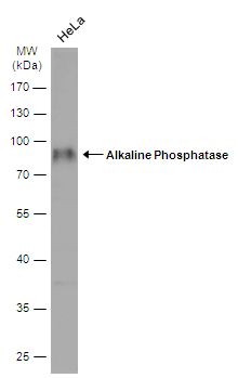 Alkaline Phosphatase Rabbit Polyclonal Antibody