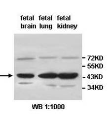 ALKBH1 Rabbit Polyclonal Antibody