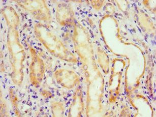 ALKBH2 antibody