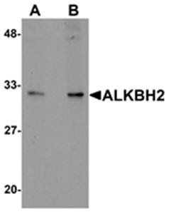 ALKBH2 Antibody