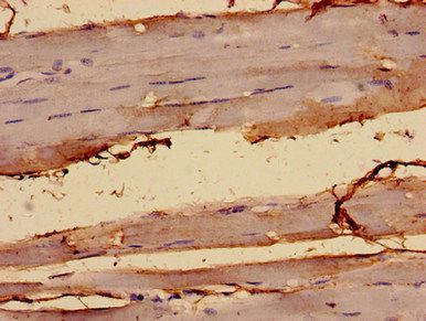 ALKBH3 antibody