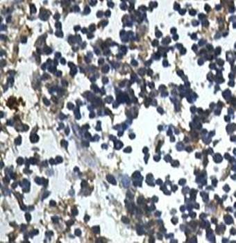 ALKBH3 Rabbit Polyclonal Antibody