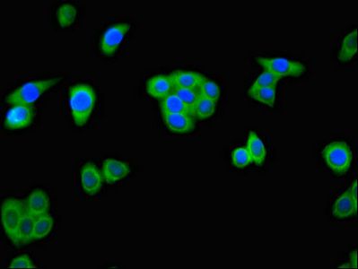 ALKBH4 antibody