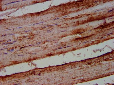 ALOX12 Antibody