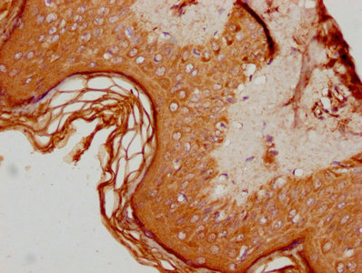 ALOX12B Antibody