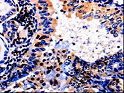 ALOX5 Antibody