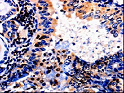 ALOX5 antibody