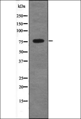 ALOX5 (Phospho-Ser663) antibody