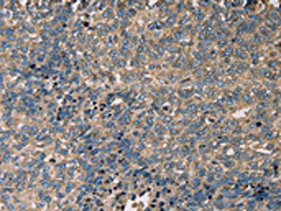 SERPINA1 Antibody