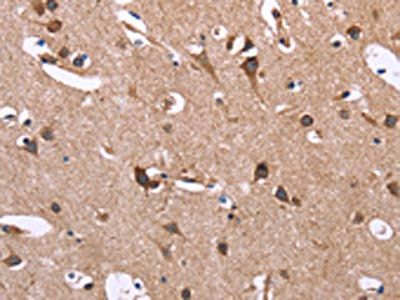 SERPINA1 Antibody