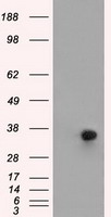 alpha 1 Antitrypsin (SERPINA1) antibody