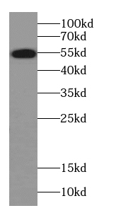 Alpha-2-antiplasmin antibody