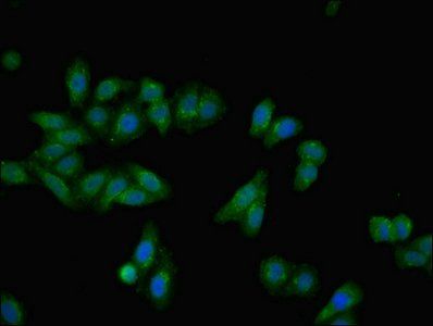 Alpha-2-HS-glycoprotein antibody