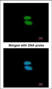 alpha Actinin 4 antibody