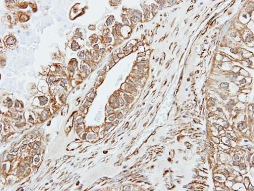 alpha amylase 2A (pancreatic) antibody