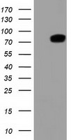 Alpha B Crystallin (CRYAB) antibody