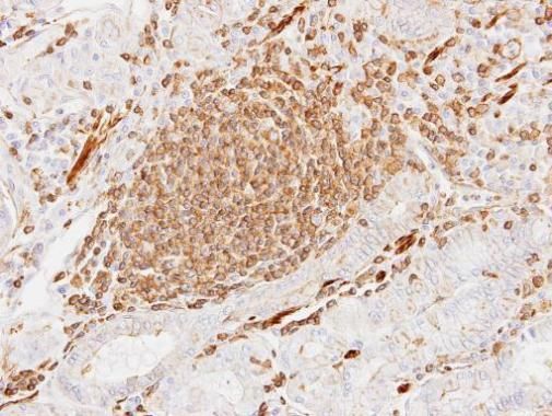 alpha Cardiac Muscle Actin Rabbit Polyclonal Antibody