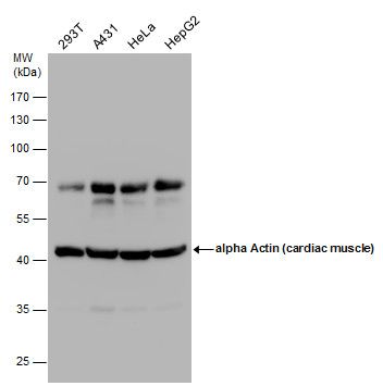 alpha Cardiac Muscle Actin Rabbit Polyclonal Antibody