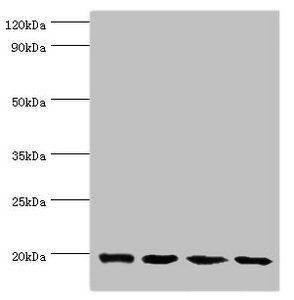 Alpha-crystallin B chain antibody