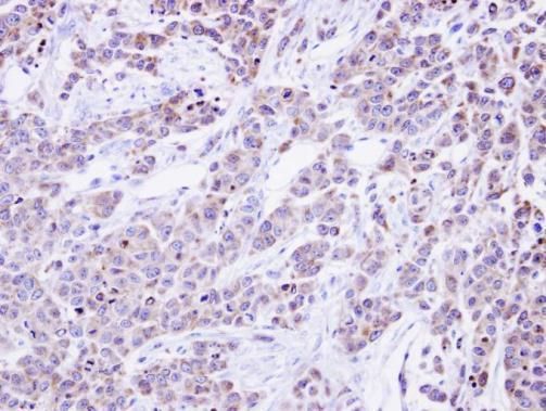 alpha Glucosidase II Rabbit Polyclonal Antibody
