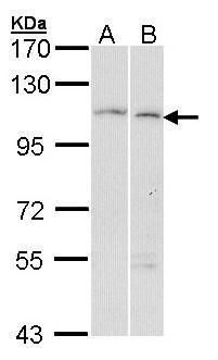 alpha Glucosidase II Rabbit Polyclonal Antibody