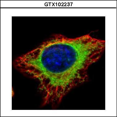 alpha Glucosidase II Rabbit Polyclonal Antibody